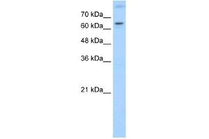 WB Suggested Anti-RORA Antibody Titration:  1. (RORA 抗体  (N-Term))