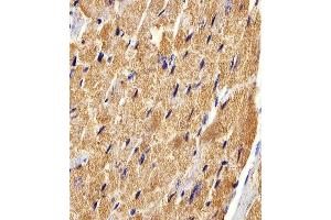 anti-Fatty Acid Binding Protein 3, Muscle and Heart (FABP3) (AA 1-133) antibody