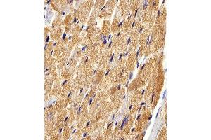Immunohistochemical analysis of paraffin-embedded M. (FABP3 抗体  (AA 1-133))