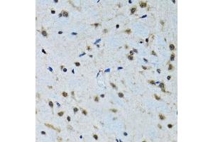 Immunohistochemistry of paraffin-embedded rat brain using IGF1 antibody (ABIN1873156) at dilution of 1:100 (40x lens). (IGF1 抗体)