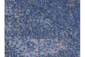 Immunohistochemistry (IHC) image for anti-Amiloride Binding Protein 1 (Amine Oxidase (Copper-Containing)) (ABP1) (AA 210-301) antibody (ABIN7437725)
