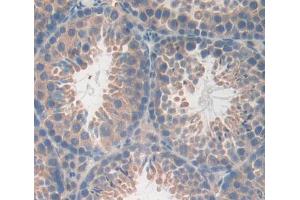 Used in DAB staining on fromalin fixed paraffin- embedded testis tissue (CA13 抗体  (AA 1-262))