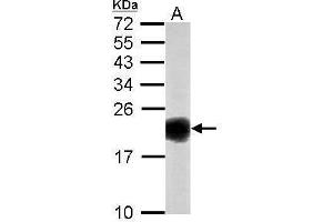 Western Blotting (WB) image for anti-Superoxide Dismutase 1, Soluble (SOD1) antibody (ABIN2854793)