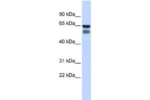 WB Suggested Anti-GALNT4 Antibody Titration:  0. (GALNT4 抗体  (Middle Region))