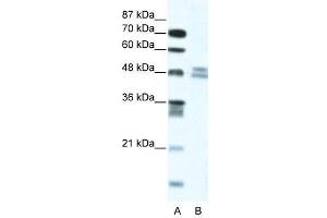 WB Suggested Anti-TRIP13  Antibody Titration: 5. (TRIP13 抗体  (N-Term))