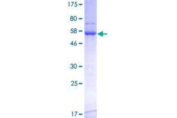 TOMM34 Protein (AA 1-309) (GST tag)