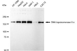 Western blotting analysis using DNA topoisomerase II alpha antibody (ABIN7800574).