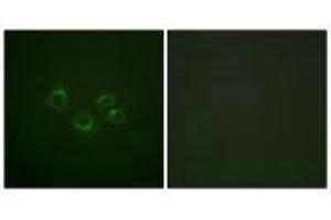 Immunofluorescence analysis of A549 cells, using EPHA2/3/4 (Ab-588/596) antibody. (EPH Receptor A2 抗体  (Tyr588, Tyr596))