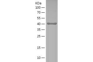 Western Blotting (WB) image for Discs, Large Homolog 4 (Drosophila) (DLG4) (AA 9-121) protein (His-IF2DI Tag) (ABIN7122678) (DLG4 Protein (AA 9-121) (His-IF2DI Tag))