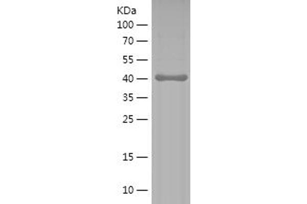 DLG4 Protein (AA 9-121) (His-IF2DI Tag)