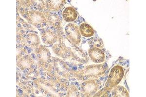 Immunohistochemistry (Paraffin-embedded Sections) (IHC (p)) image for anti-Phosphatidylinositol-5-Phosphate 4-Kinase, Type II, alpha (PIP4K2A) antibody (ABIN7263459)