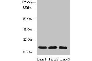 Western blot All lanes: SSR3 antibody at 10 μg/mL Lane 1: Hela whole cell lysate Lane 2: U87 whole cell lysate Lane 3: A431 whole cell lysate Secondary Goat polyclonal to rabbit IgG at 1/10000 dilution Predicted band size: 22, 23 kDa Observed band size: 22 kDa (SSR3 抗体  (AA 77-135))