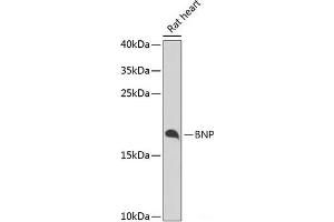 Western blot analysis of extracts of Rat heart using BNP Polyclonal Antibody at dilution of 1:1000. (BNP 抗体)