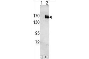 Western blot analysis of HER2(arrow) using rabbit polyclonal HER2 antibody. (ErbB2/Her2 抗体)