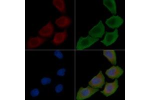ABIN6257628 and ABIN6274171 staining Hela cells(30 min of UV treatment) by IF/ICC.