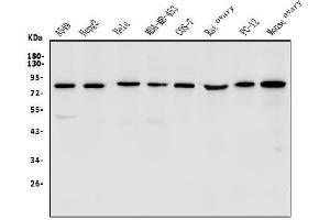 Western blot analysis of LPP using anti-LPP antibody (ABIN7602831).