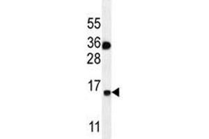 S100A1 antibody western blot analysis in MDA-MB435 lysate. (S100A1 抗体  (AA 45-75))