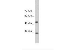 Image no. 2 for anti-Aryl Hydrocarbon Receptor Interacting Protein (AIP) (AA 101-150) antibody (ABIN202262) (AIP 抗体  (AA 101-150))