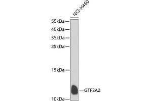 Western blot analysis of extracts of NCI-H460 cells, using GTF2 antibody  at 1:1000 dilution. (GTF2A2 抗体  (AA 1-109))