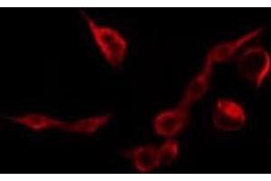 ABIN6269090 staining HepG2 by IF/ICC. (Integrin beta 3 抗体  (C-Term))