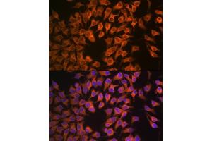 Immunofluorescence analysis of HeLa cells using CYP17 Rabbit mAb (ABIN7266648) at dilution of 1:100 (40x lens). (CYP17A1 抗体)