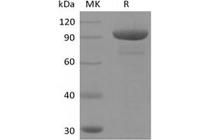 Western Blotting (WB) image for 5'-Nucleotidase, Ecto (CD73) (NT5E) (Active) protein (Fc Tag) (ABIN7319798) (CD73 Protein (Fc Tag))