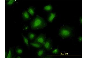 Immunofluorescence of monoclonal antibody to CDR2 on HeLa cell. (CDR2 抗体  (AA 296-404))