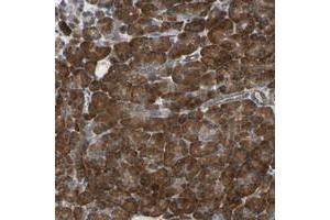 Immunohistochemical staining of human pancreas with CLCC1 polyclonal antibody  shows strong cytoplasmic positivity in exocrine glandular cells at 1:200-1:500 dilution. (CLCC1 抗体)