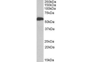 ABIN2561038 (1µg/ml) staining of Human Liver lysate (35µg protein in RIPA buffer). (ALDH5A1 抗体  (AA 301-312))