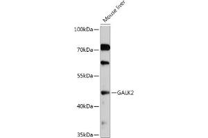 Western blot analysis of extracts of Mouse liver, using G antibody (ABIN7267329) at 1:1000 dilution. (GALK2 抗体  (AA 109-458))