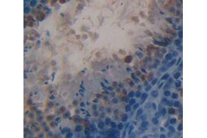 Used in DAB staining on fromalin fixed paraffin- embedded testis tissue (HSD17B3 抗体  (AA 1-310))