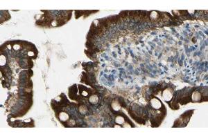 ABIN6269135 at 1/100 staining Mouse intestine tissue by IHC-P. (BCR 抗体  (Internal Region))
