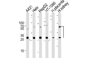 Western blot analysis of lysates from A431, Hela, HepG2, HT-1080 cell line and human placenta, kidney tissue lysate (from left to right), using CTSA Antibody (N-term) (ABIN654433 and ABIN2844169). (CTSA 抗体  (N-Term))