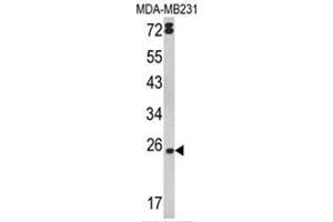 Western blot analysis of LTA Antibody (Center) in MDA-MB231 cell line lysates (35ug/lane). (LTA 抗体  (Middle Region))