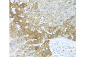 Immunohistochemistry of paraffin-embedded Mouse liver using BCL2L2 Polyclonal Antibody at dilution of 1:100 (40x lens). (BCL2L2 抗体)
