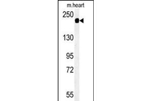 Western blot analysis of SD9L Antibody (C-term) (ABIN651359 and ABIN2840201) in mouse heart tissue lysates (35 μg/lane). (SAMD9L 抗体  (C-Term))