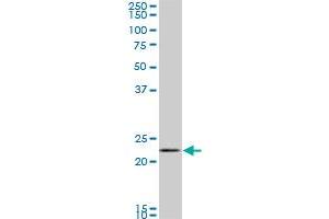 RAB11A monoclonal antibody (M01), clone 1F7-2A8. (RAB11A 抗体  (AA 1-216))