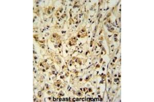 Immunohistochemistry (IHC) image for anti-Small Cell Adhesion Glycoprotein (SMAGP) antibody (ABIN3002290)