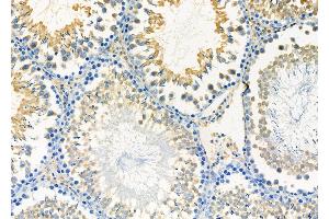 ABIN6263399 and ABIN6277160 at 1/100 staining Rat testis tissue by IHC-P. (Moesin 抗体  (C-Term))