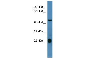 WB Suggested Anti-SSTR1 Antibody Titration: 0. (SSTR1 抗体  (C-Term))