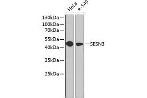 Western blot analysis of extracts of various cell lines, using SESN3 antibody (ABIN6129128, ABIN6147627, ABIN6147628 and ABIN6220862) at 1:1000 dilution. (SESN3 抗体  (AA 1-310))