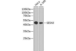 Western blot analysis of extracts of various cell lines, using SESN3 antibody (ABIN6129128, ABIN6147627, ABIN6147628 and ABIN6220862) at 1:1000 dilution. (SESN3 抗体  (AA 1-310))