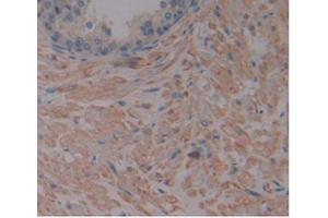 IHC-P analysis of Human Prostate Gland Tissue, with DAB staining. (MMP2 抗体  (AA 110-660))