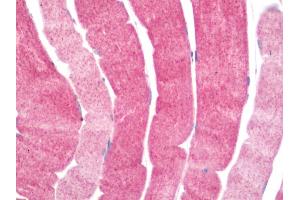 Human Skeletal Muscle: Formalin-Fixed, Paraffin-Embedded (FFPE) (PDCL3 抗体  (C-Term))
