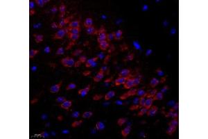Immunofluorescence of paraffin embedded mouse hippocampus using C1orf173 (ABIN7074073) at dilution of 1: 300 (400x lens) (Glutamate-Rich Protein 3 (ERICH3) 抗体)