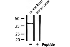 Western blot analysis of extracts from mouse heart, using BMI1 Antibody. (BMI1 抗体  (Internal Region))