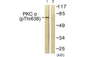Western blot analysis of extracts from NIH-3T3 cells treated with UV 15', using PKC alpha (Phospho-Thr638) Antibody. (PKC alpha 抗体  (pThr638))