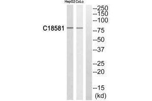 Western blot analysis of extracts from HepG2 cells and COLO205 cells, using NEK5 antibody.