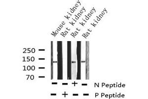 Western blot analysis of Phospho-Calcium Sensing Receptor (Thr888) expression in various lysates (CASR 抗体  (pThr888))