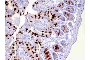IHC analysis of TFF3 using anti-TFF3 antibody . (TFF3 抗体  (AA 23-81))